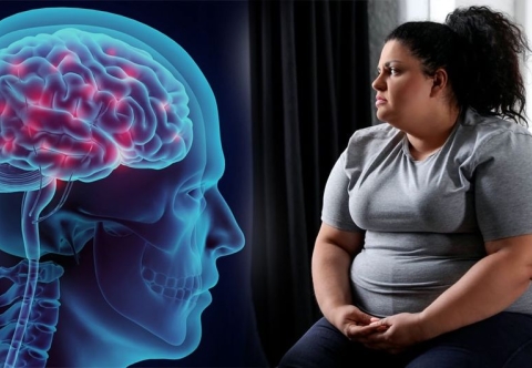 Béo phì có làm giảm hoạt động chức năng của bộ não hay không